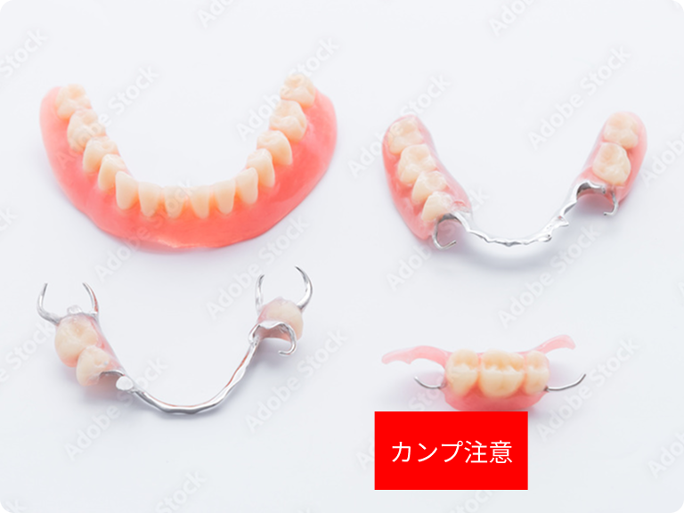 入れ歯治療の様子