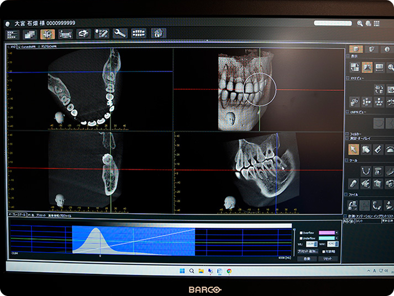 治療計画のご提案