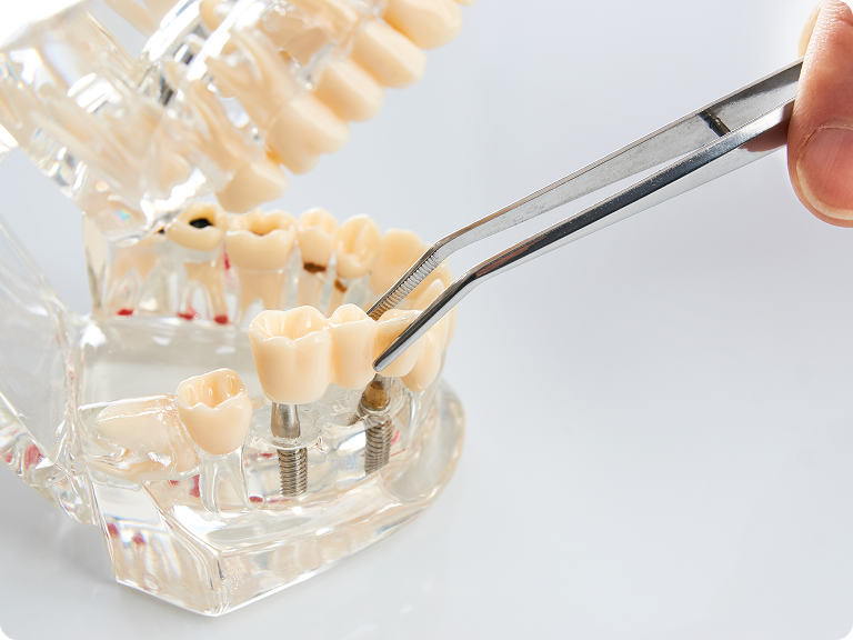 自由診療のご提供