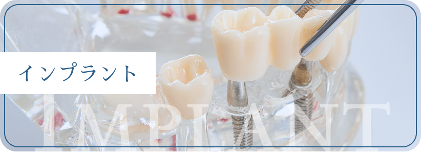 インプラント